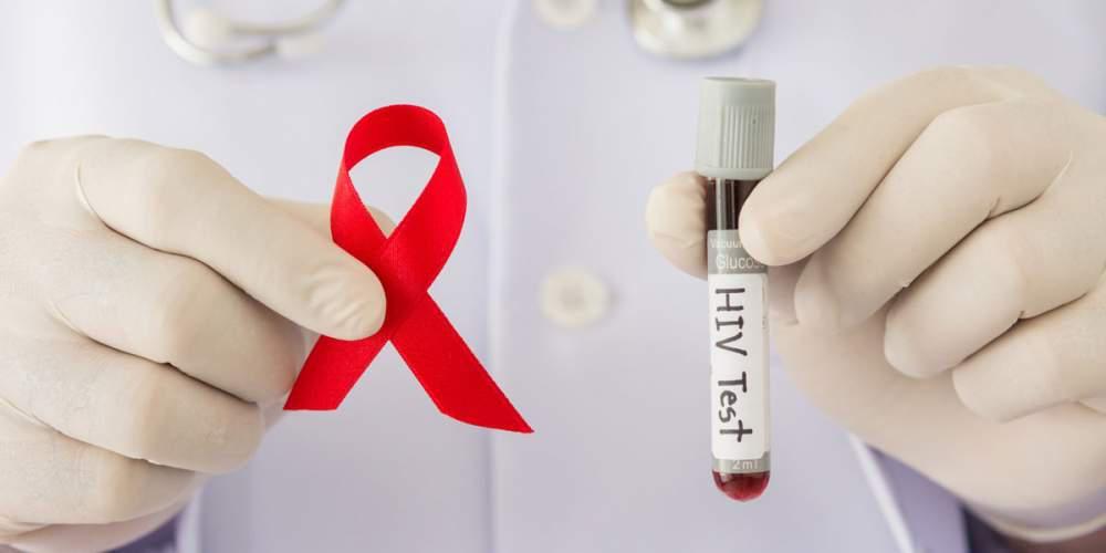 HIV AIDS