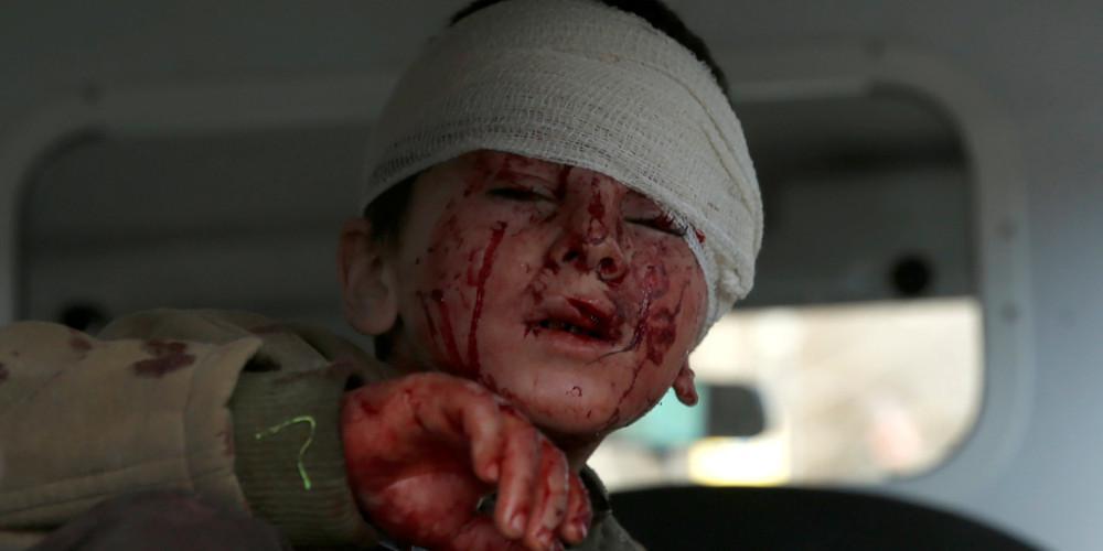 Νέο «λουτρό αίματος» στην Καμπούλ με 95 νεκρούς και εκατοντάδες τραυματίες [εικόνες σοκ]
