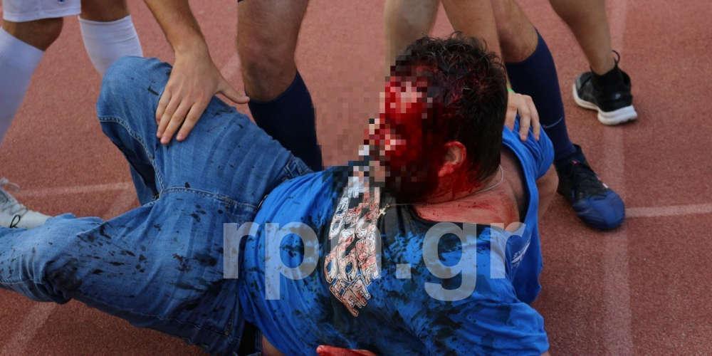 Αγριο ξύλο και τραυματισμοί σε αγώνες ποδοσφαίρου σε Αττική και Θεσσαλονίκη