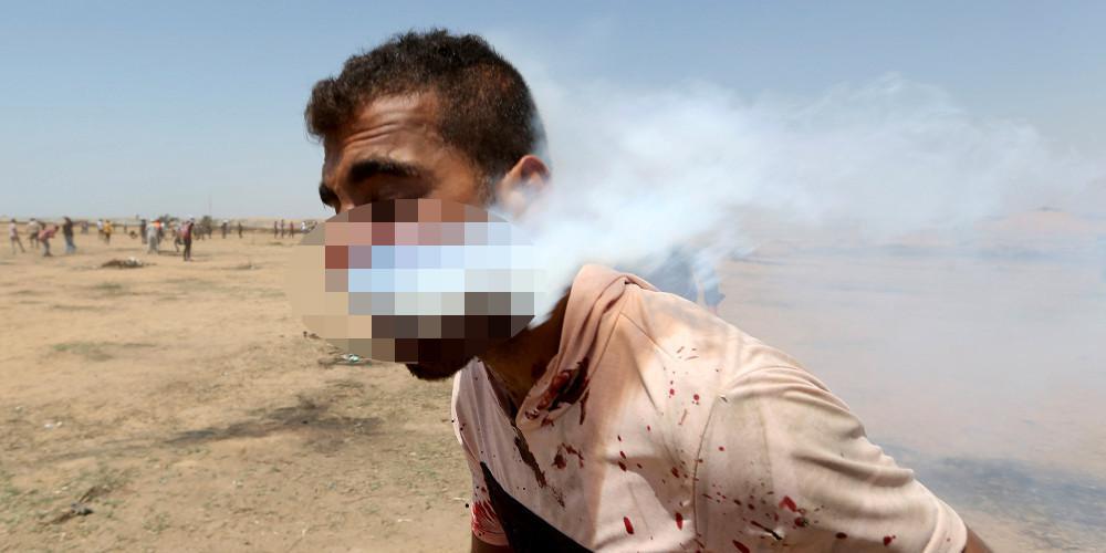 Σοκαριστική εικόνα: Καρφώθηκε δακρυγόνο στο πρόσωπο Παλαιστίνιου διαδηλωτή