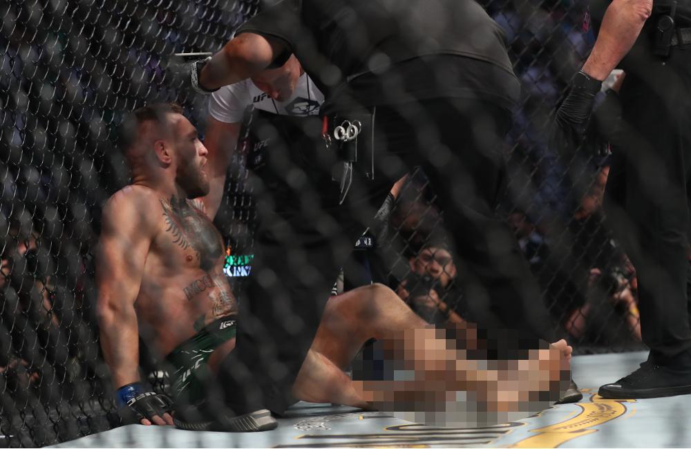 UFC: Ανατριχιαστικός τραυματισμός του ΜακΓκρέγκορ [σκληρές εικόνες]