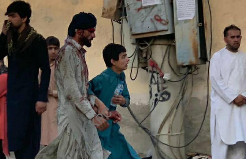 Καμπούλ: Μακελειό με πάνω από 60 νεκρούς και 150 τραυματίες