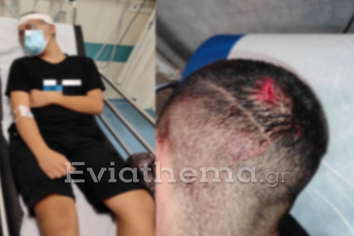 ΣΟΚ στο Αλιβέρι: 15χρονος τραυματίστηκε στο κεφάλι από επίθεση 21χρονου κατόχου «μαύρης ζώνης»