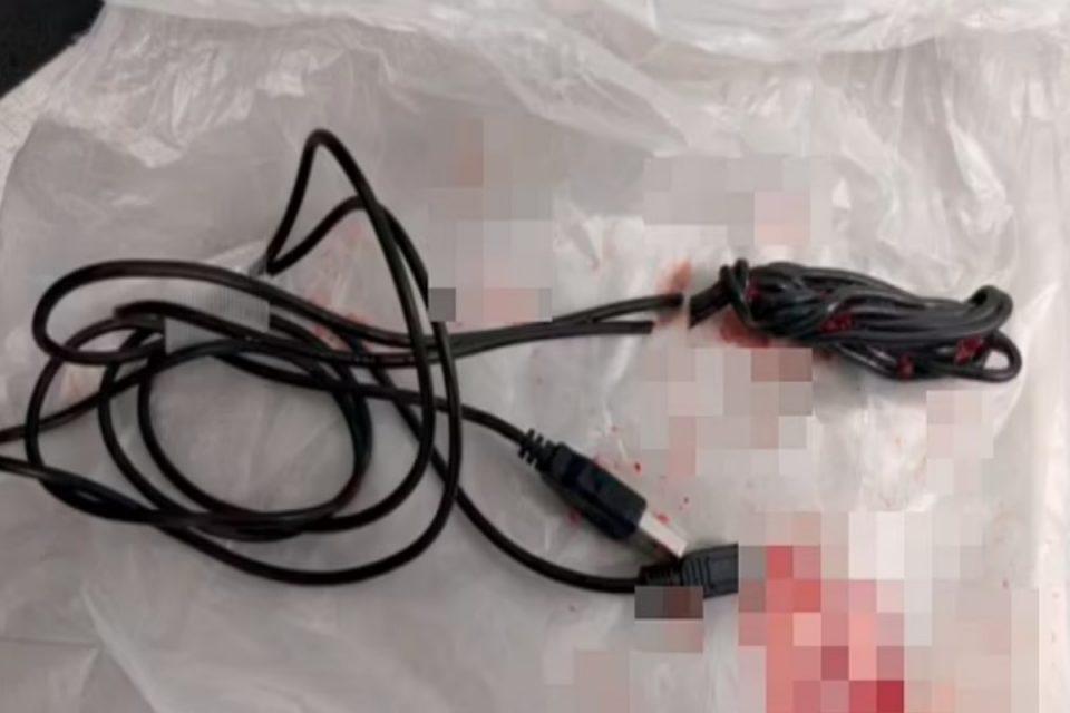 15χρονος σφήνωσε καλώδιο USB στο πέος του και κατέληξε στο νοσοκομείο