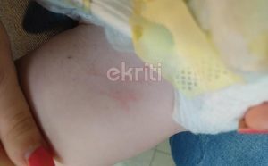 Κρήτη: Σοκαριστικές εικόνες από την επίθεση του σκύλου σε μωρό