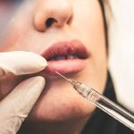 Συναγερμός από τον ΙΣΑ: Botox από ερασιτέχνες προκαλούν παραμορφώσεις