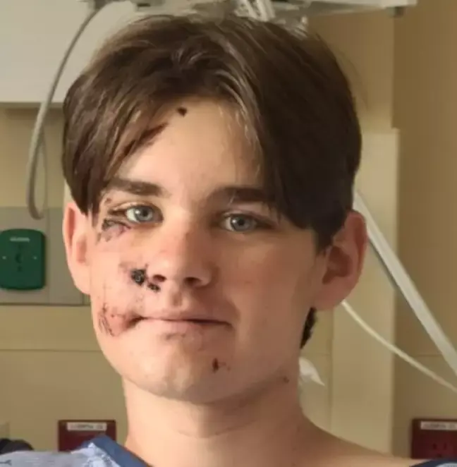 Γκραντ Κάνυον: 13χρονος επέζησε από πτώση 30 μέτρων