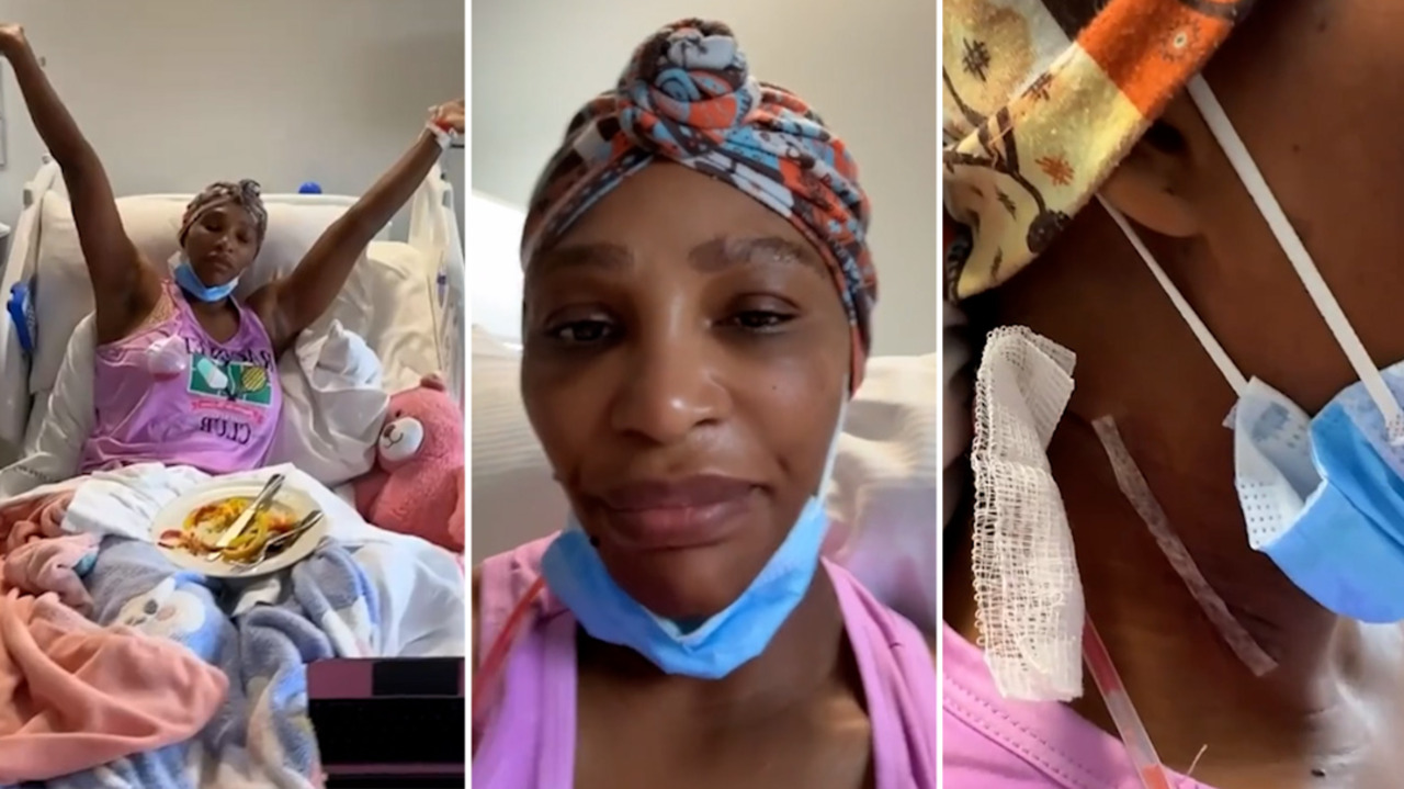 Serena Williams Reveals She Had Cyst Removed from Her Neck – ‘It Was the Size of a Grapefruit’ (VIDEO)